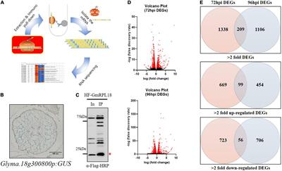 High-Resolution Translatome Analysis Reveals Cortical Cell Programs During Early Soybean Nodulation